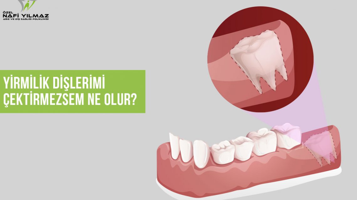 yirmilik_diş_çekimi