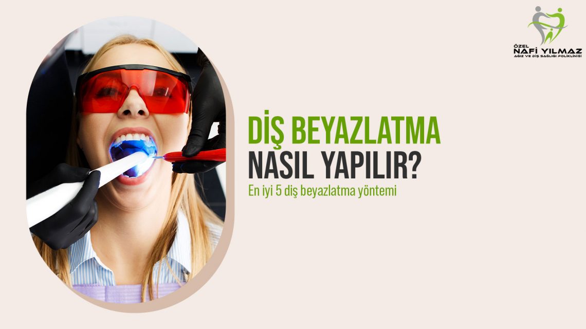 diş beyazlatma